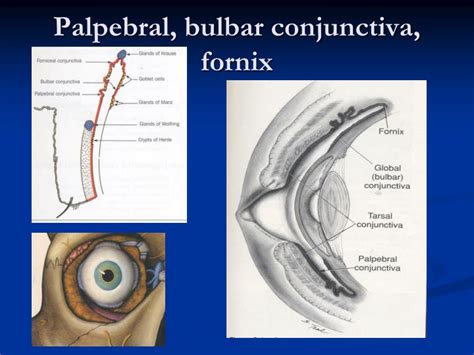 Ppt The Disease Of Conjunctiva 結膜 Sclera 鞏膜 Powerpoint Presentation Id3679518