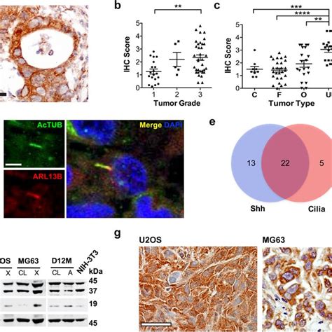 Hedgehog Signaling And Primary Cilia Formation In Human Osteosarcoma In