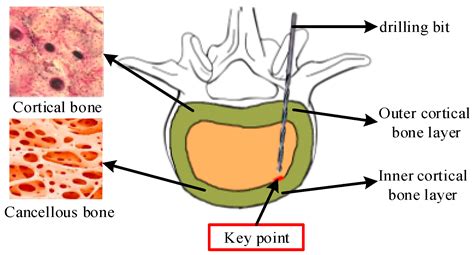 Cortical Vs Cancellous Bone