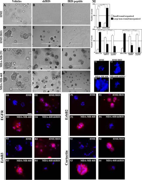 BRCA1 IRIS Overexpression Promotes Aggressiveness In HME Cells While