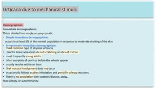 Urticaria ,types and management bolognia .pptx