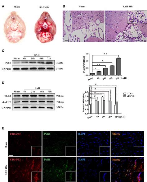 Frontiers Peli1 Contributions In Microglial Activation