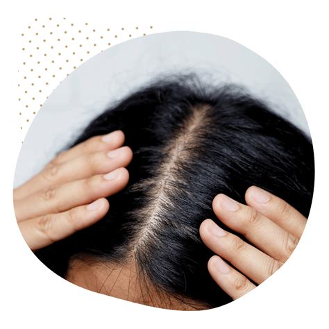 Exosome Hair Therapy - Restore Hair & Boost Confidence