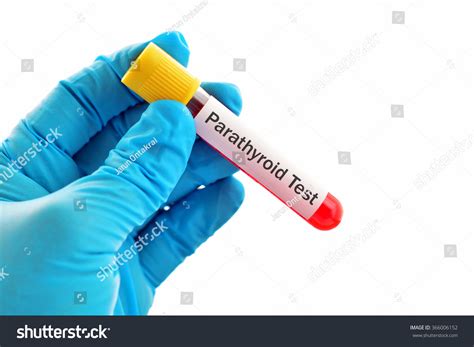 Blood Sample Parathyroid Hormone Pth Test库存照片366006152 | Shutterstock