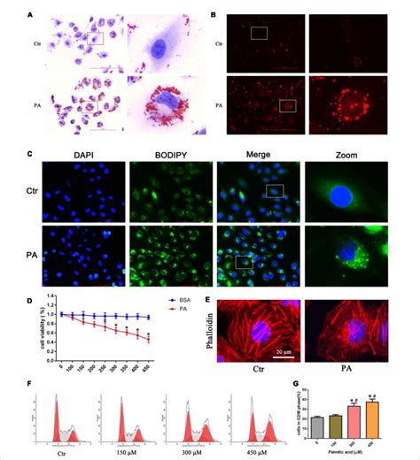 Palmitic Acid PA Induced Lipid Accumulation And Cell Injury In HK 2