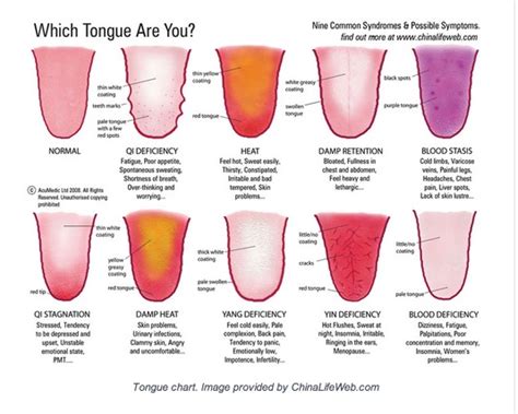 hs-acupuncture - Blog - Tongue Diagnosis Revealed