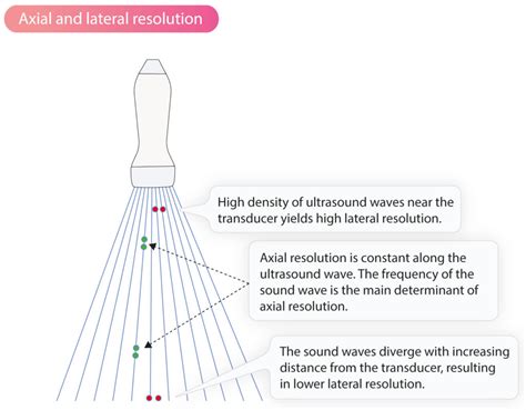 Technical Aspects Of The Ultrasound Image Cardiovascular Education