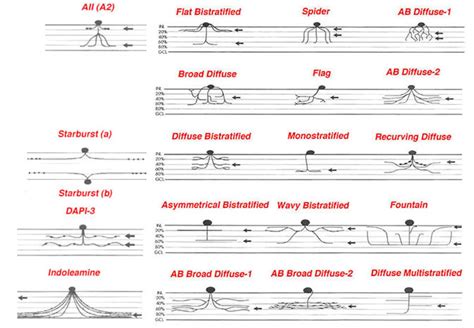 [figure Figure 2 Schematic Drawings Of ] Webvision Ncbi Bookshelf