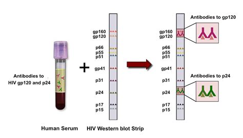 Western Blot HIV