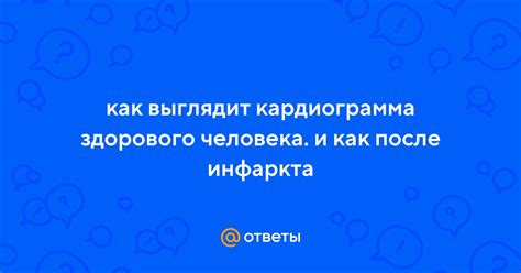 Ответы Mail: как выглядит кардиограмма здорового человека. и как после ...
