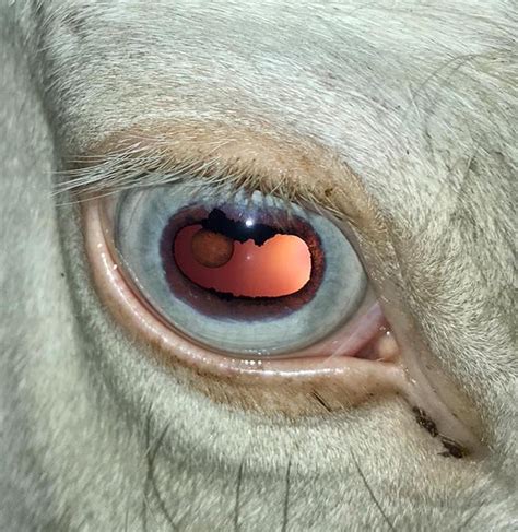 Noninvasive Diode Laseran Effective And Safe Treatment Of Iris Cysts