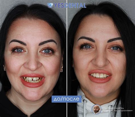 Стоматология YesDental