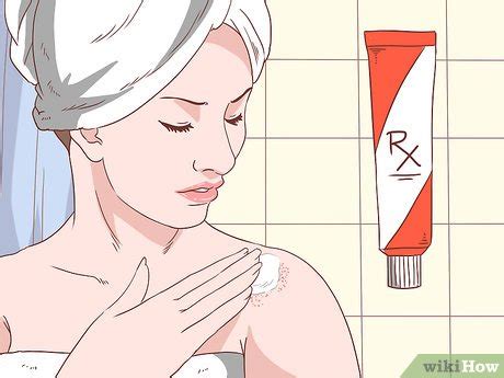 Ways To Handle An Eczema Flare Up Wikihow