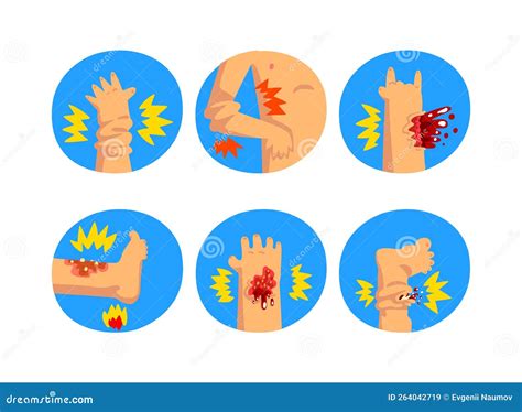 First Aid For Wounded Arm And Leg In Blue Circle Vector Set Stock