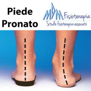 Piede Pronato Una Guida Completa Mdm Fisioterapia