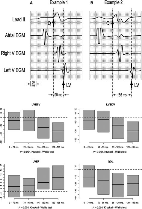 Optimal Pacing for Right Ventricular and Biventricular Devices