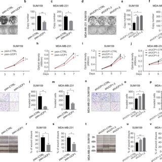 Ucp Suppresses The Proliferation Invasion And Migration Ability Of