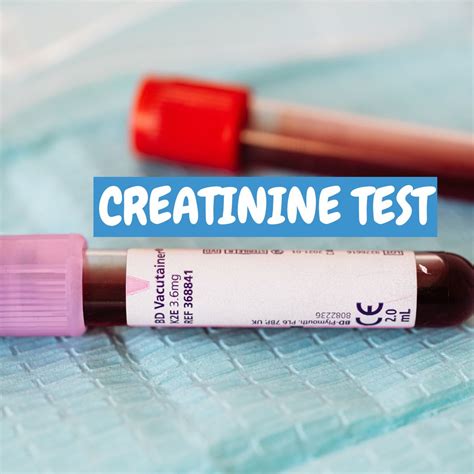 Creatinine Test: Serum, Clearance, Level - bigman lab