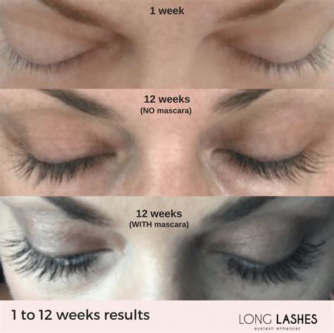 Long Lashes Eyelash Growth Serum 35ml • Lash Envy Melbourne