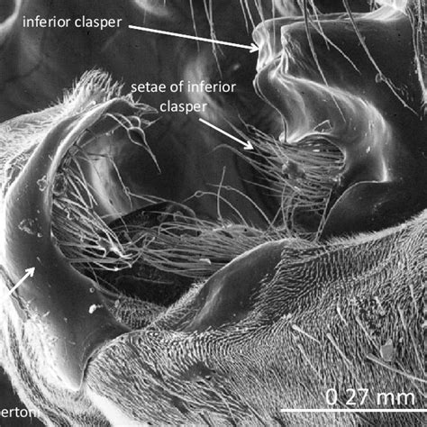 Scanning Electron Microscope Sem Lateral View Of Cerci And Inferior