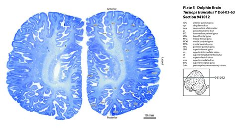 Atlas Of The Brain Of A Dolphin — Comparative Brain Anatomy