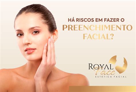 Riscos Do Preenchimento Facial Eles Existem