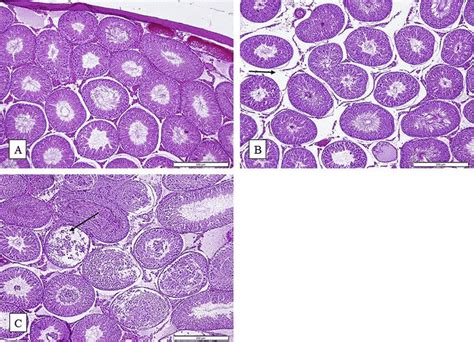 Light Microscopy Of Transverse Sections Of Testes Isolated From