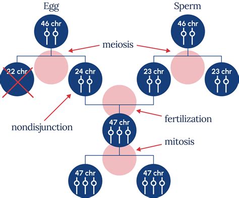 About Down Syndrome | National Down Syndrome Society (NDSS)