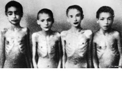 Josef Mengele Experiments On Dwarfs