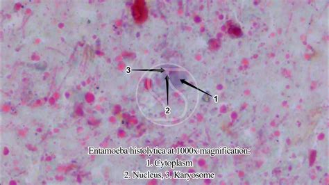 Entamoeba Histolytica With Trichrome Stain Youtube