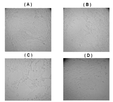 Microphotographs of MCF-7 cell line after the cytotoxicity test: (a ...