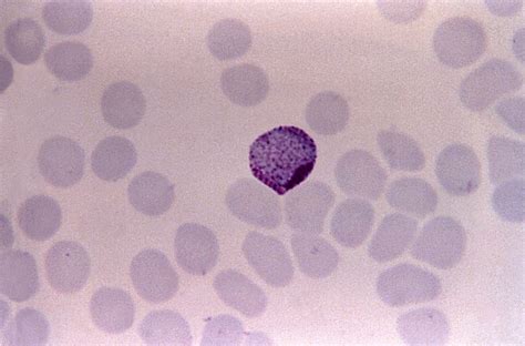 Free picture: micrograph, plasmodium vivax, macrogametocyte, distinct, schufners, dots, mag, 1125x