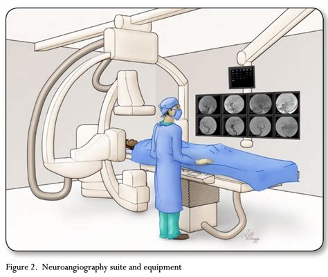 A VISUAL GUIDE TO CEREBRAL ANGIOGRAM | Supreme Vascular and ...