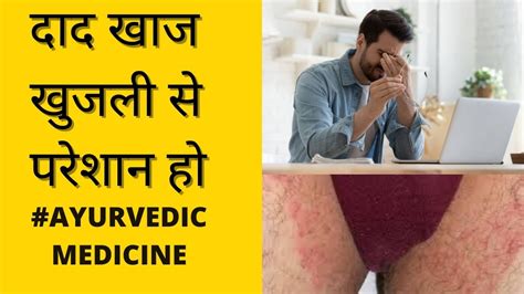 Fungal Infection In Private Part Daad Khaj Khujli Ayurvedic Medicine