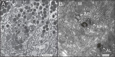 Application Of Transmission Electron Microscopy To Detect Changes In