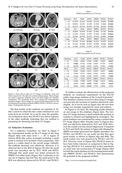 Low Dose Ct Image Denoising Using Image Decomposition And Sparse