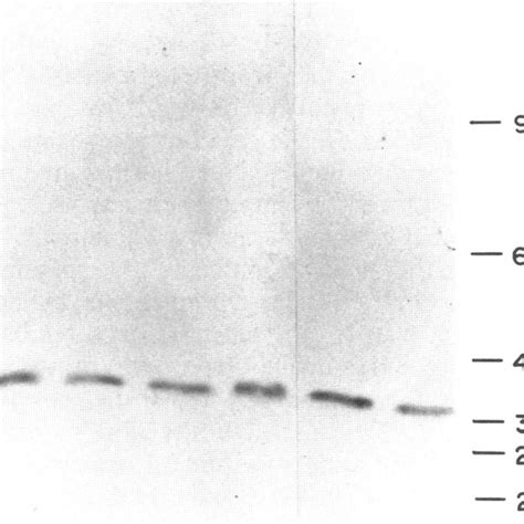 Immunoblot Analyses Of Human Uracil DNA Glycosylases Human Uracil DNA