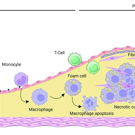 Atherosclerosis Initiation And Progression The Early Development Of Download Scientific