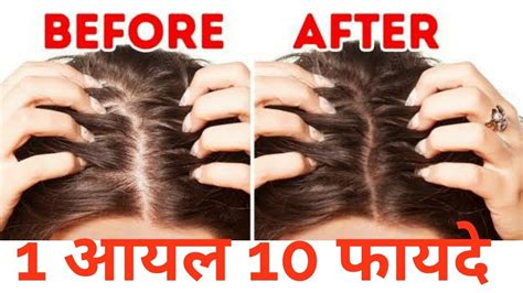 Stop Hair Fall Immediately And Grow New Hair 100 Effective Youtube