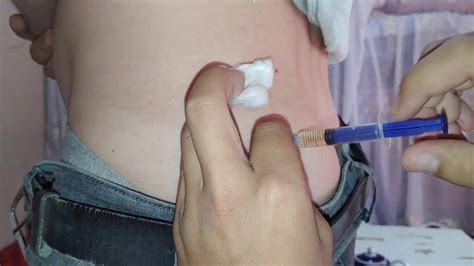 Injection In Ass Video 9 ThisVid