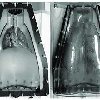 Anthropomorphic Ex Vivo Porcine Chest Phantom A The Porcine