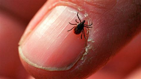 How To Avoid Ticks And What To Do If You Get Bitten Shots Health