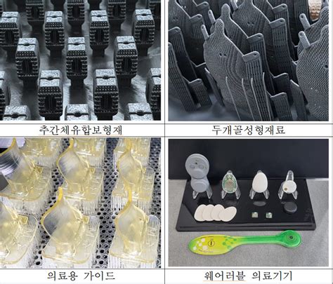경북대 첨단기술원 고기능 인체결합 의료기기산업육성 플랫폼 구축사업 추진 전자신문