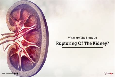 What are The Signs Of Rupturing Of The Kidney? - By Dr. Garima | Lybrate