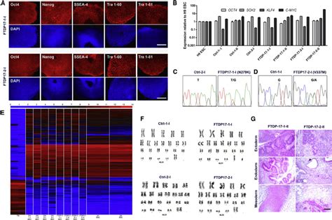 Derivation And Characterization Of Ctrl And FTDP 17 IPSCs A