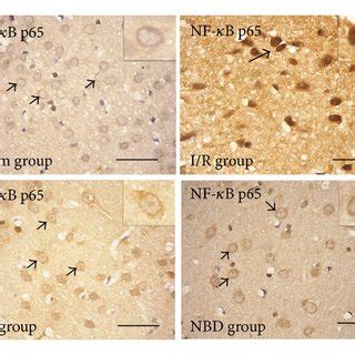 Immunohistochemical analysis of the nuclear translocation of NF κB p65