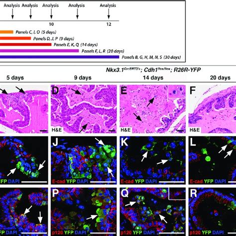 Inducible Deletion Of E Cadherin In The Prostate Epithelium Download Scientific Diagram