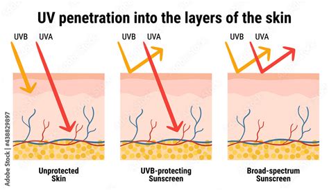 Vetor De Uv Penetration Into The Layers Of The Skin Infographic Of Sunscreen Protection Against