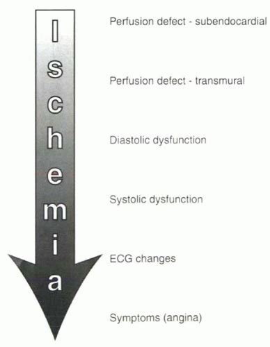 Ischemic Cardiac Disease Thoracic Key