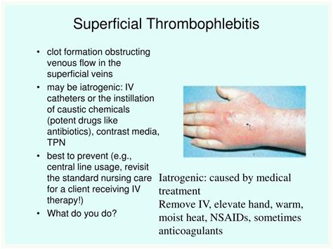 Ppt Peripheral Vascular Disease Powerpoint Presentation Free Download Id3358000